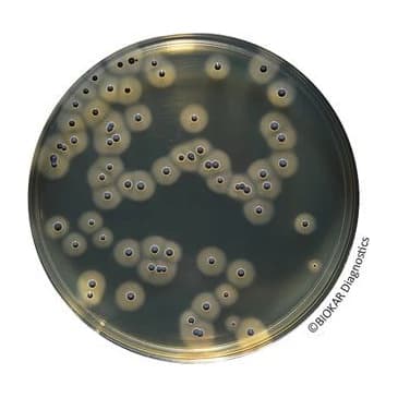 Baird Parker RPF Agar 20 Placas