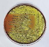 EMB Agar (Levine) BK056